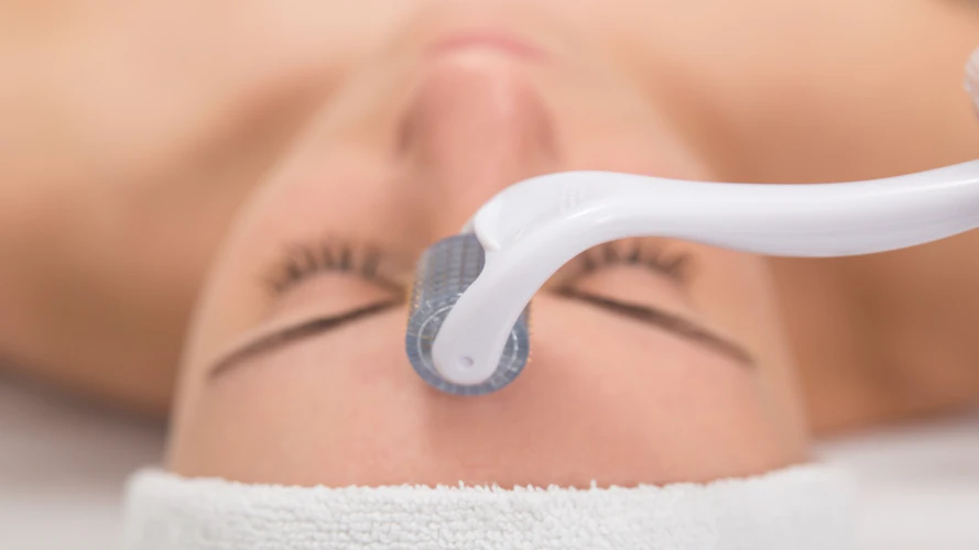 Woman receiving a microneedling treatment